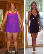 becky-tummy-tuck-before-after.jpg