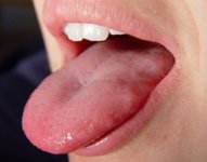 tongue-180107_a[1].jpg