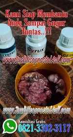 Cara Menggugurkan Kandungan Atau Aborsi Dengan Pil Cytotec 400 µg Misoprostol (Obat Penggugur ...jpg