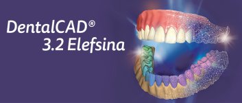 exocad_DentalCAD_3_2_Elefsina_Press_Area_940x400.jpg exocad_DentalCAD_3_2_Elefsina_Press_Area_940x400.jpg