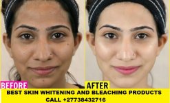 Skin Bleaching and whitening in Senagal +27738432716.jpeg Skin Bleaching and whitening in Senagal +27738432716.jpeg