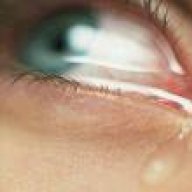 دموع حارقه